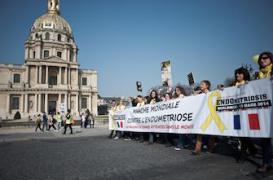 Endométriose : l'infertilité menace près de la moitié des femmes