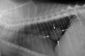 Cancer du poumon : détecter les signes précoces avec un test sanguin 