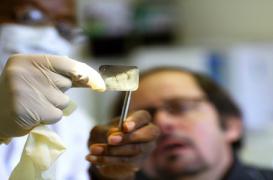 Soins dentaires: le low cost peut coûter cher