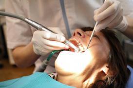 Les caries diminueraient le risque de cancer 