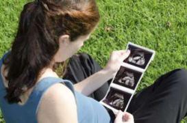 Le don d’ovocytes triple le risque d’hypertension pour la femme enceinte