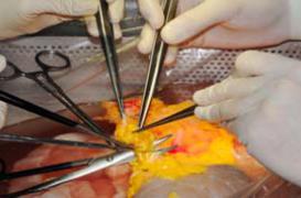 Don du vivant : 98% des donneurs de rein seraient prêts à le refaire