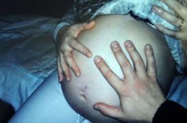 Accouchement : les soignants appuient sur le ventre dans 1 cas sur 3