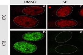 Cancers : un diurétique pour améliorer la chimiothérapie 