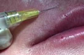 La médecine esthétique entre dans le cabinet du généraliste