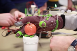 Handicap : un gant bionique imprimé en 3D