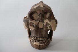 Herpès génital : le 