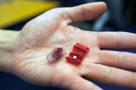 Un robot décoince des objets dans l’estomac