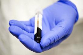 Analyses sanguines : des protéines de soie pour conserver les échantillons