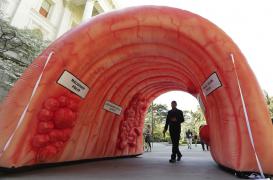 Cancer du colon : progression inquiétante chez les jeunes 