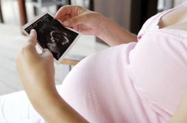 Grossesse : traiter la polyarthrite n'attaque pas les os des bébés