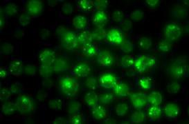 L'interleukine 2 prouve son efficacité