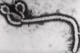 Ebola : des chercheurs découvrent pourquoi il est si mortel