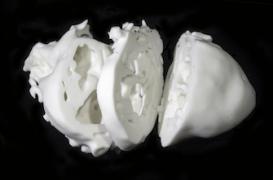 Malformations cardiaques : l’impression 3D au secours de la chirurgie
