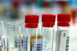 Le bilan de santé pour tous de la sécu est inefficace