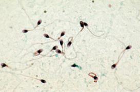 Infertilité masculine : des produits chimiques du quotidien mis en accusation