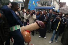 Un américain est resté 8 mois en érection après une opération