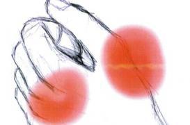 Arthrose : 10 millions de victimes et toujours méconnue