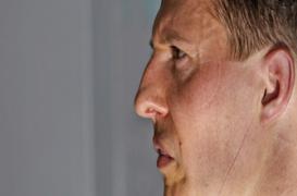 Schumacher : pourquoi les médecins ne peuvent pas se prononcer  