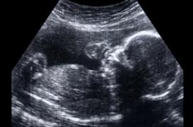 9 couples sur 10 veulent connaître le sexe de leur futur enfant