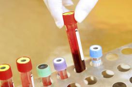 40 % d’amniocentèses en moins grâce au dépistage précoce