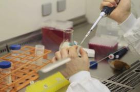 Drépanocytose : reprogrammer les gènes pour traiter la maladie