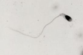 Fertilité : l’aluminium réduit la qualité du sperme