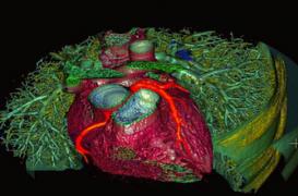 Les insuffisants cardiaques sous surveillance rapprochée