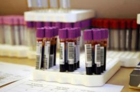 Dépister 13 types de cancer avec un test sanguin