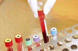 Un test sanguin pour prédire son risque de décès dans les 5 ans