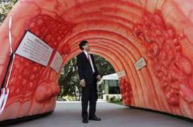 Cancer colorectal : la maladie progresse chez les jeunes 