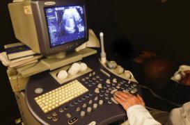 Erreur d'implantation d'embryons : qui a la garde des jumeaux ?