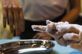 Sida : des anticorps puissants font disparaître le virus