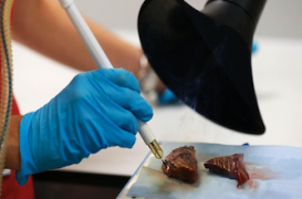 Un bistouri intelligent pour identifier les tumeurs cancéreuses