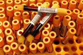 Hépatite C : la guérison totale à portée de main