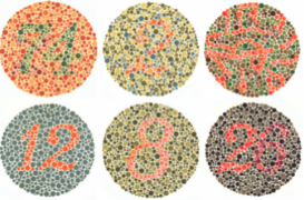 Daltonisme : les garçons à la peau blanche sont plus touchés