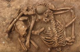 Le cancer existait déjà il y a 3 200 ans 