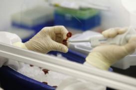 Dangereux mélange de souches de grippe aviaire aux Etats-Unis