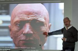 Robespierre : diagnostic de variole et sarcoïdose 219 ans après sa mort