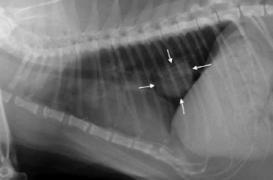 Cancer du poumon : le test sanguin, une avancée majeure ? 