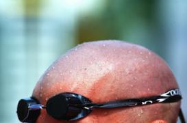 Les chauves doivent surveiller leur coeur