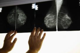 Cancers héréditaires : les médecins pourront prévenir l'entourage
