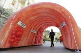 Cancer colorectal : des tests de dépistage plus efficaces bientôt disponibles