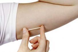 Stérilets hormonaux : efficaces 5 ans après leur pose