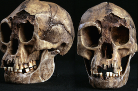 L’homme de Florès n'était pas une nouvelle espèce mais trisomique