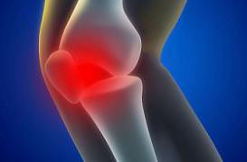 Anti-arthrosiques : menace sur le remboursement