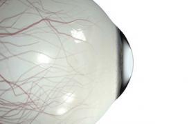 Rétine artificielle: des aveugles déchiffrent des lettres