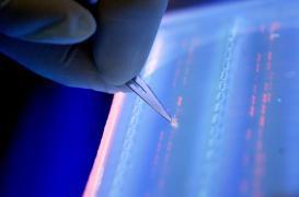 Maladie d'Alzheimer : 11 nouveaux gènes identifiés