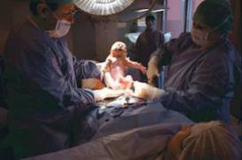 Une 1ère césarienne complique les autres accouchements 