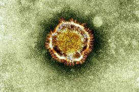 Coronavirus: le tableau clinique des victimes